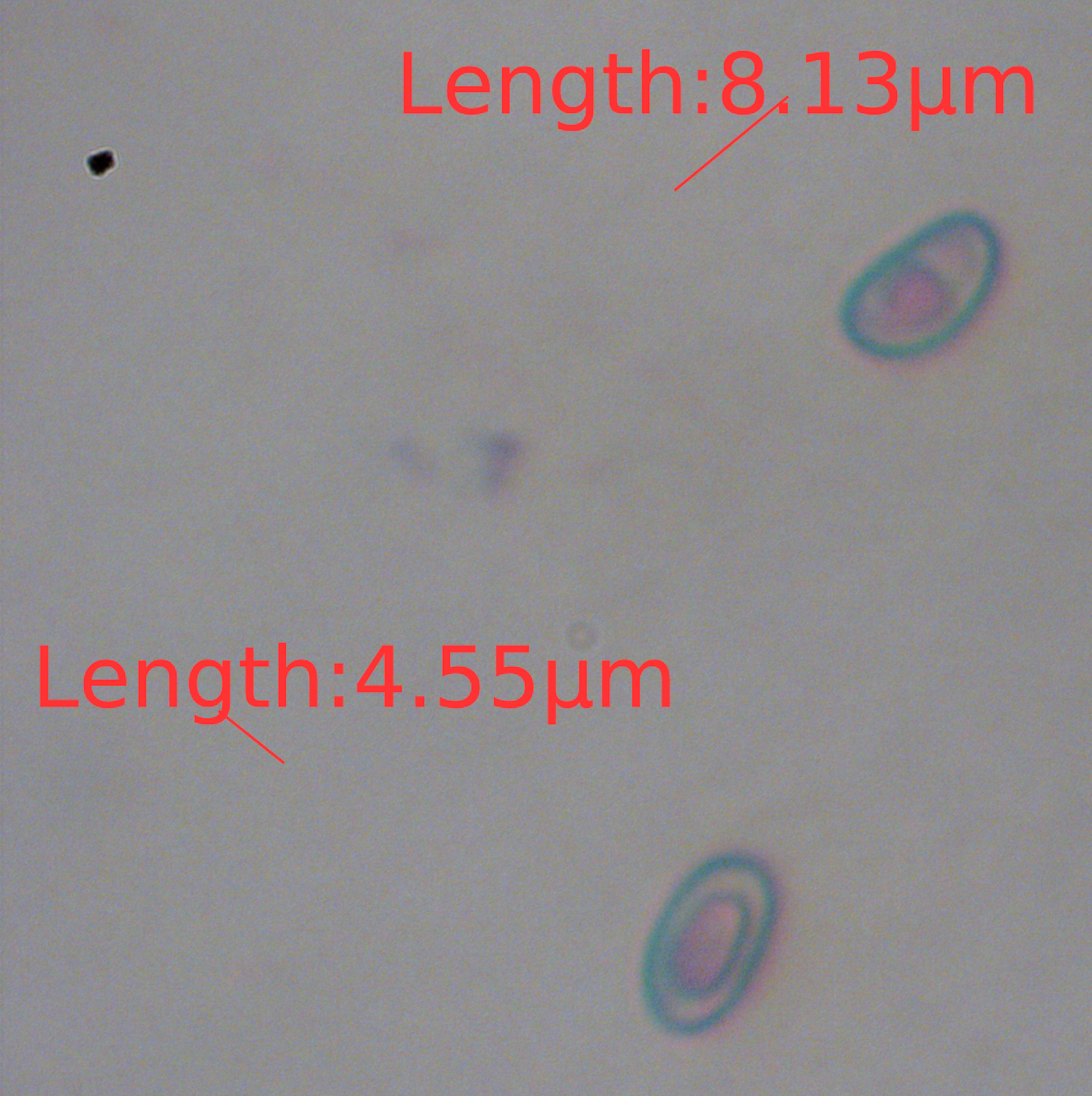 Spores 100X with measure bar